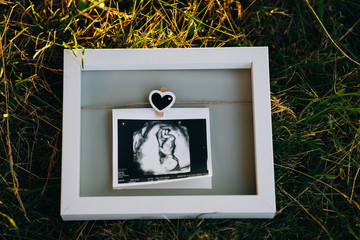 Frame with ultrasound photo