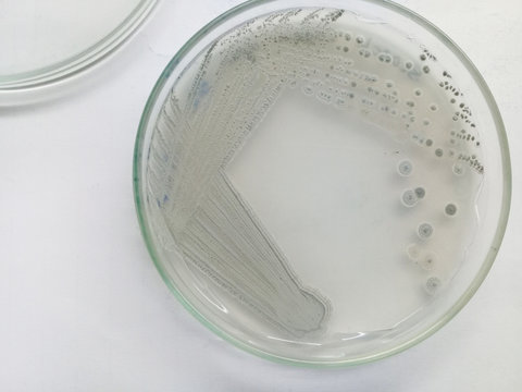Actinomycete Organism isolated from soil - streaked on agar plate - ash pigment producing actinomycete