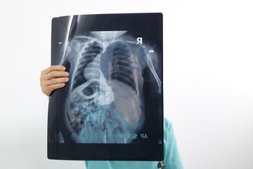 Doctors examining x-ray of chest