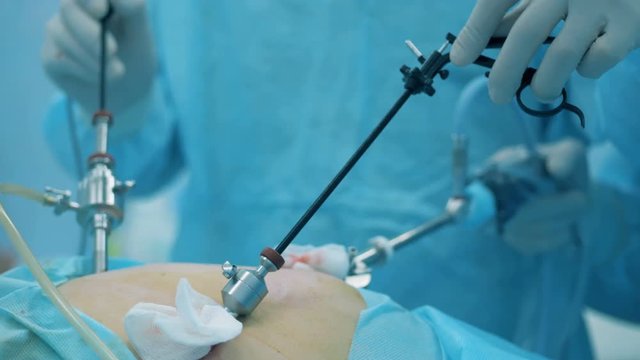 Surgeon is performing a medical procedure on an abdominal cavity