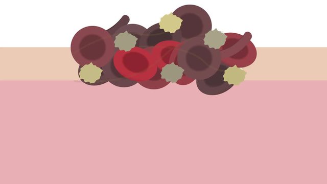 platelet and fibrin on wound graphic animation
