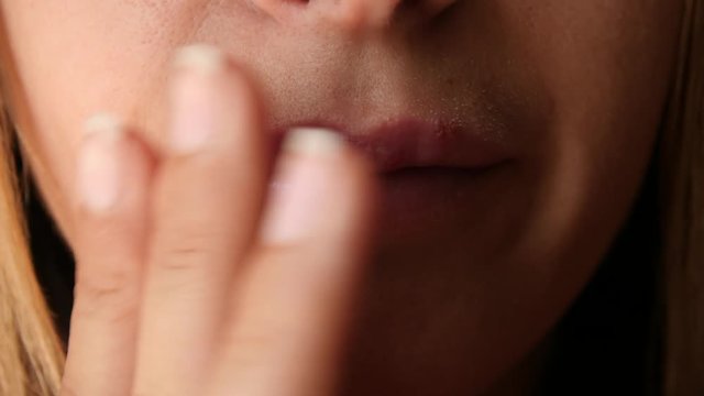 Woman touches the sores from herpes on her lips. Women's lip ulcers herpes closeup. Beautiful lips were covered with cold sores. The girl licks her lips covered with herpes.