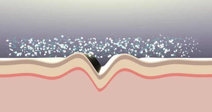 Wrinkle correction procedure. Effect after using anti agining skin care products