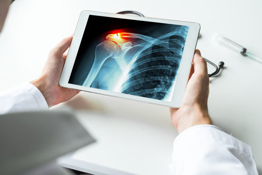 Doctor watching-a-x-ray of broken shoulder with pain on digital tablet. Radiology concept