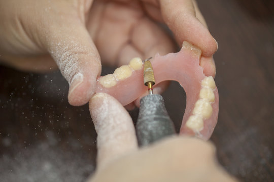 Close up of hands dental technician make denture prothesis in dental laboratory