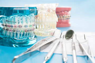 orthodontic model and dentist tool - demonstration teeth model of varities of orthodontic bracket or brace