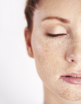 Half Of Woman's Face With Freckle