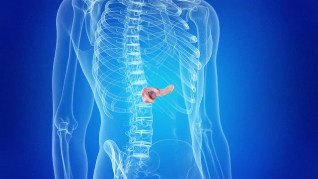 medical 3d animation of a pancreas tumor