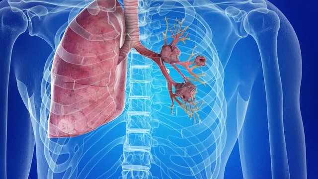 medically accurate 3d animation of lung cancer