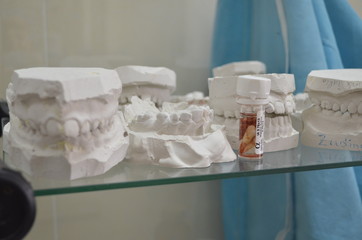 Dental prints