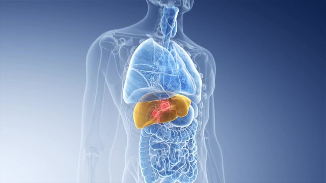 3d rendered medically accurate animation of liver cancer