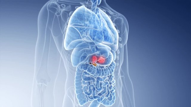 3d rendered medically accurate animation of pancreas cancer