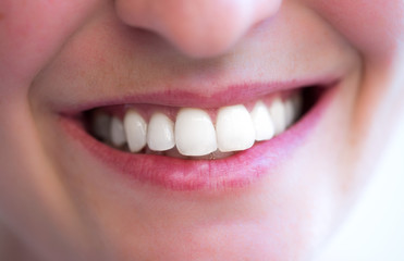 Strahlend weiße gesunde Zähne und rote Lippen, Lächeln 