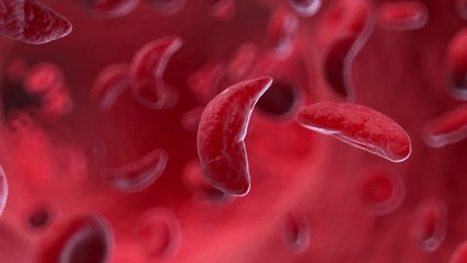 3d rendered medically accurate animation of a sicklecell