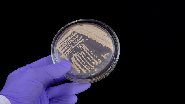 A microbiologist examines bacterial colonies on a petri dish. Visual inspection of bacterial colonies. A pure bacterial strain. A petri dish with bacteria colonies on a black background.