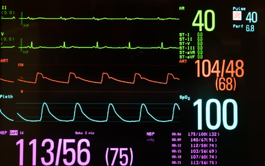 Medical Monitor Showing Slow Heart Rate or Bradycardia, Blood Pressure, and Oxygen Saturation - obrazy, fototapety, plakaty