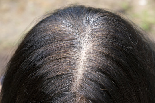 Young Woman Shows Her Gray Hair Roots, Close Up