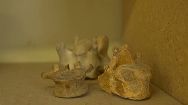 Old human body spinal cord bones exposed on an anatomy laboratory.