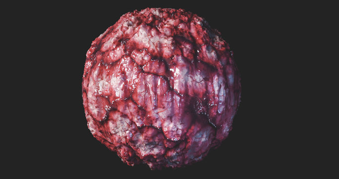 Cancer Cell Oncology Concept Cancer Tumor Cyst Carcinoma Lymphoma Colon Cancer Brest Cancers  3d Rendering 