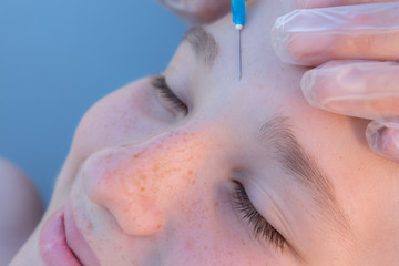 Portrait of teenage girl doing botox injection of hyaluronic acid in forehead skin close up, concept of youth and beauty