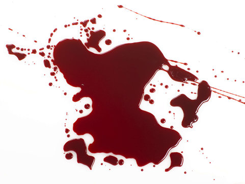 Puddle of blood