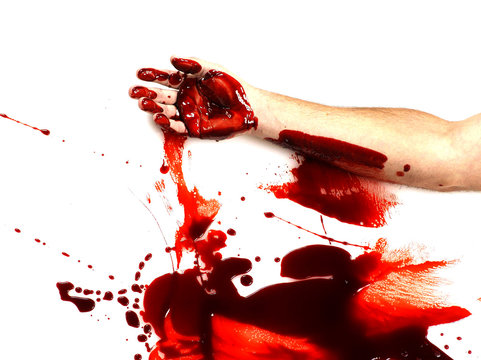 Arm lying in spilled blood