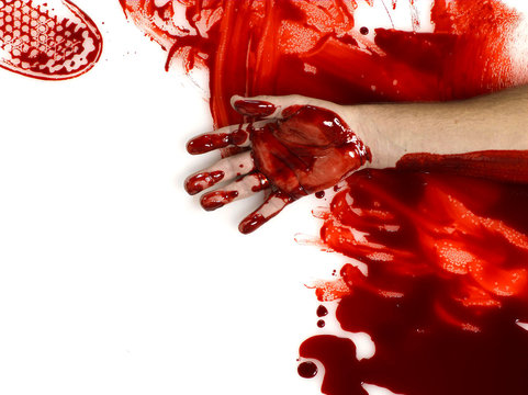 Arm lying in spilled blood