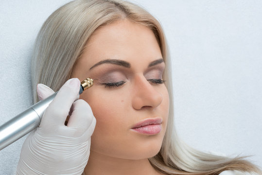 Fibroblast skin care procedure, wrinkle eyelids lifting.