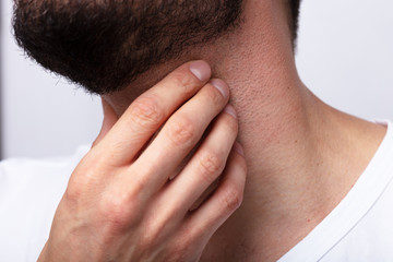 Fototapeta premium Man Suffering From Sore Throat