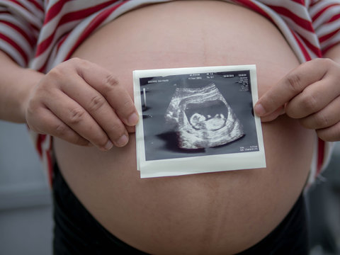 Pregnant woman holding ultrasound scan on her tummy