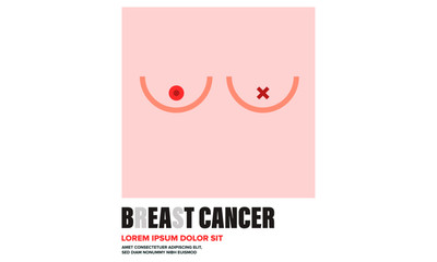 Breast Cancer Awareness Design Template for banner/poster/blog. Beat Cancer. Vector illustration of Breasts after Cancer.