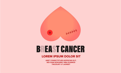 Breast Cancer Awareness Design Template for banner/poster/blog. Beat Cancer. Vector illustration of Breasts after Cancer.
