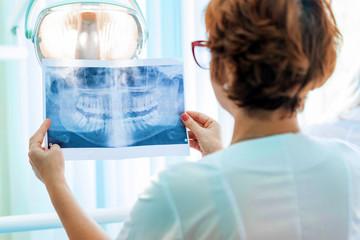 A dentist examines orthopantomogram in her hands