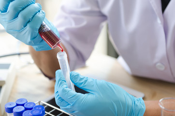 A pipette dropping sample into a test tube,abstract science background