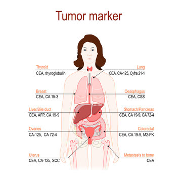 Tumor marker or biomarker. silhouette of a woman with internal organs.