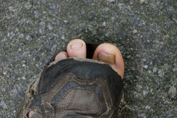 ragged sneaker with toes on the asphalt