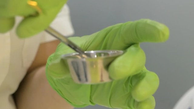 PRF dental implant method,preparing blood samples for analsys