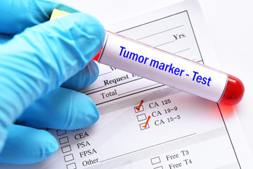Blood sample tube with laboratory requisition form for tumor marker test - obrazy, fototapety, plakaty