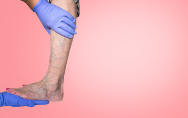 Lower limb vascular examination because suspect of venous insufficiency. The female legs on pink background