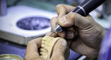 歯科技工