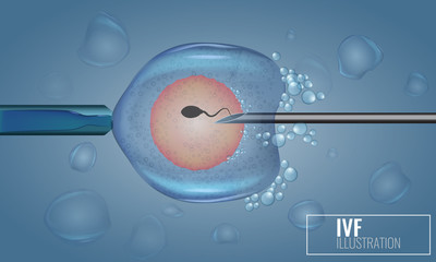 In Vitro Fertilization injection. Artificial insemination. Scientific medical illustrated vector.