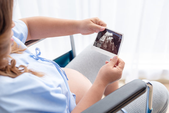 Young mother in the hospital chair holding and looking to the x-ray film of her baby. Mother preparing for the newborn.