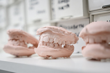 Dental casting gypsum model plaster cast stomatologic human jaws prothetic laboratory, technical...