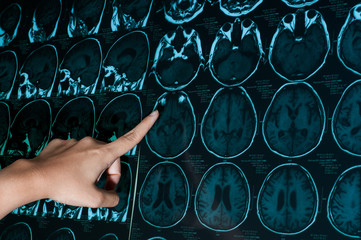 Research in medicine. CT scan of the patient.