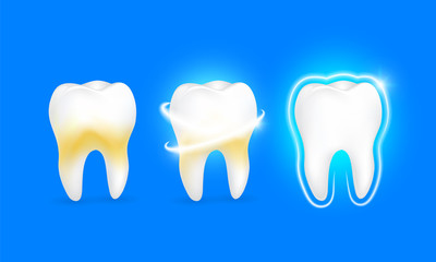 Set of  clean and dirty tooth on blue background, clearing tooth process. Teeth Whitening. Dental health Concept. Oral Care, teeth restoration. Yellow and white teeth.