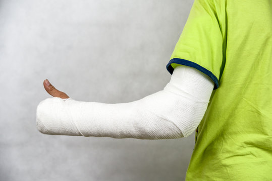 Broken hand in cast