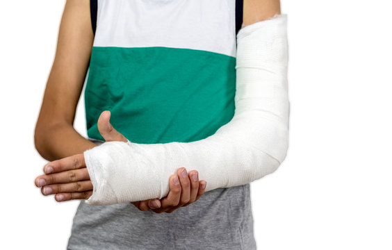 Broken arm in cast
