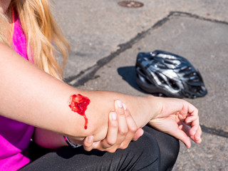 Frau mit Schürfwunde nach Fahrradsturz
