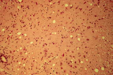 Cell of a living organism in the microscope