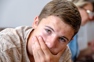 The portrait of pimply teenager covered his mouth with his hand. The concept of toothache, fear, fear of speaking out, unwillingness to talk.